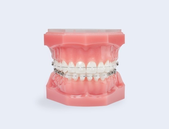 Adult & Pediatric Orthodontics - Clear Braces