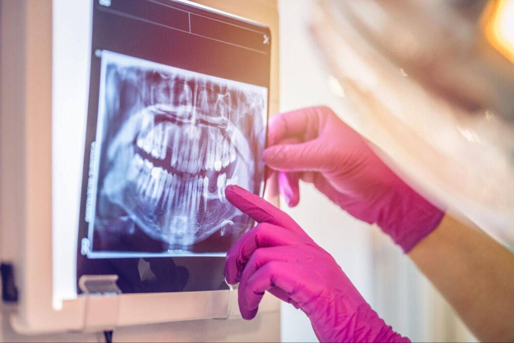 How Do X-Rays Track Progress In Orthodontics?