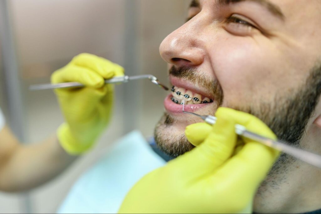 What to Do When Braces Break?